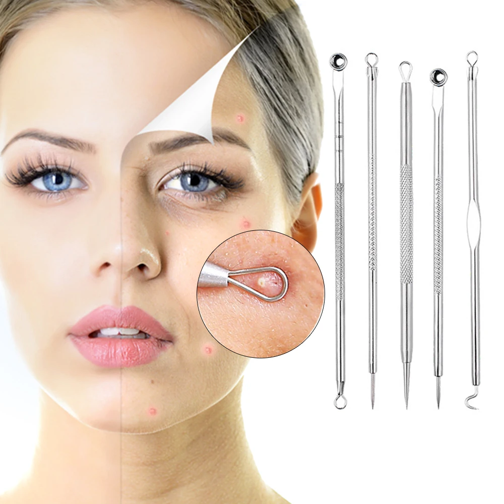 blackhead remover pimple comedone extractor tool acne kit blackhead remover pimple comedone extractor tool acne kit