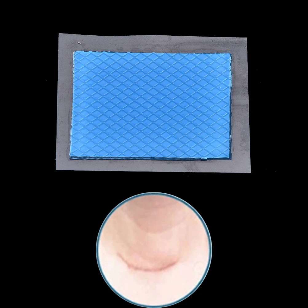 1 шт. силикон шрама патч Acne гель терапии многоразовые силиконовый пластырь удалить "сжечь лист восстановления кожи 5 см x 3,5 см