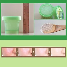 Гель алоэ вера 120 г для постугревых рубцов удаление Pockmark отбеливающий увлажняющий крем эмульсия уход за лицом js002