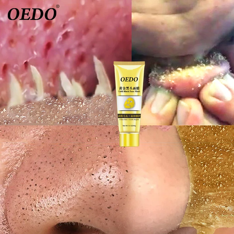 OEDO Золотая и черная маска удаляет пятна черного цвета поры лицо очищает