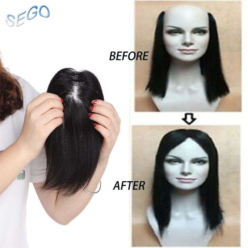 SEGO Diameter 9cm Straight Weld Base HairTopperToupee For Women Natural Color Human Hair Pieces Indian Hair Closure 150% Density