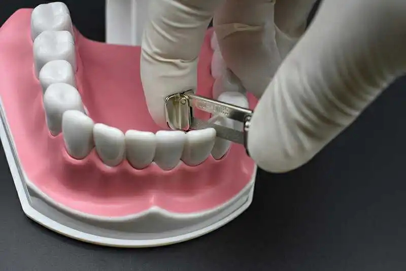 

RZ3S Orthodontic Supplies Interproximal Enamel Reduction Hand Use Tool Can Replaced Diamond Strips, have 2 pcs Diamond Strips