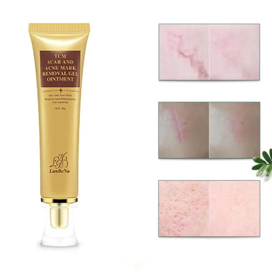 

Cream Ginseng Essence Anti Acne Remover Cream Face Care Makeup Spots Stretch Marks Remove