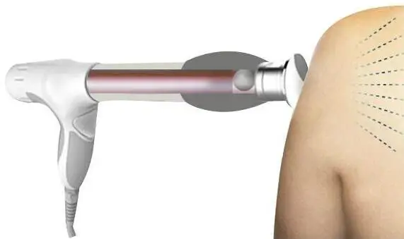 US $1.979.96 2000000 Shots Shock Wave Therapy MachineShock Wave Therapy MachineExtracorporeal Shock Wave Therapy German Imported Compressor