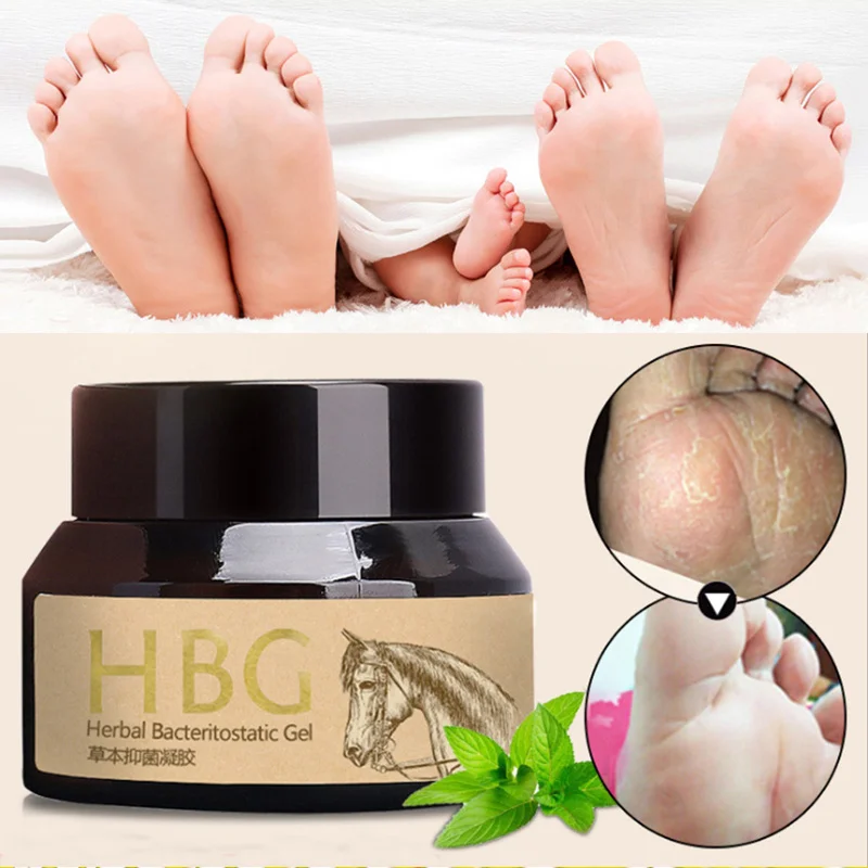 

Beriberi Cream For Athlete's Foot Feet Itch Blisters Anti-chapping Peeling Beriberi Bad Feet Ointment Herbal Gel Feet Cream Care