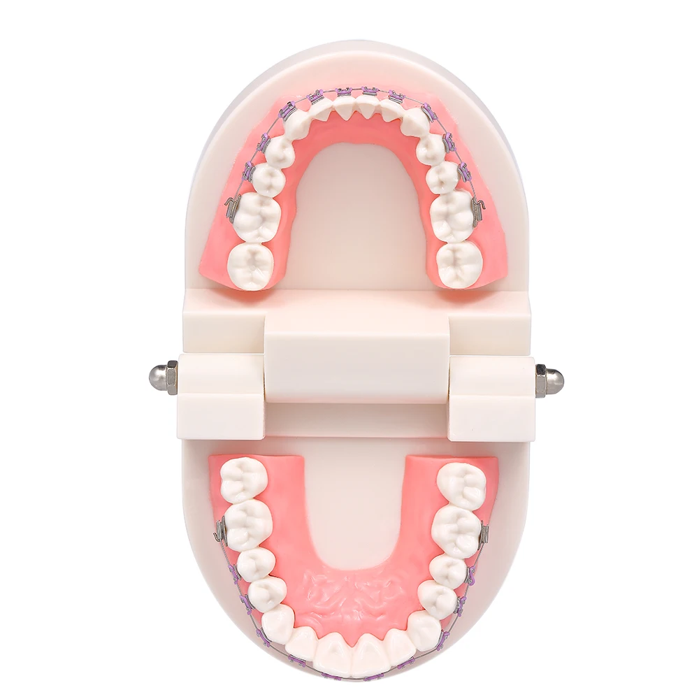 Щечной трубки Зубы Модель Стоматологическая Ортодонтического Mallocclusion модель с кронштейны дугу для пациента Связь взрослых преподавания