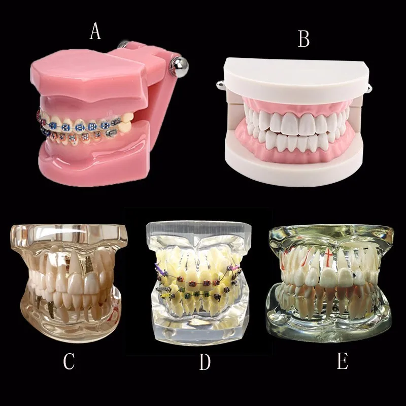 Различные стоматологические модели зубов используются для обучения и больничных стоматологов
