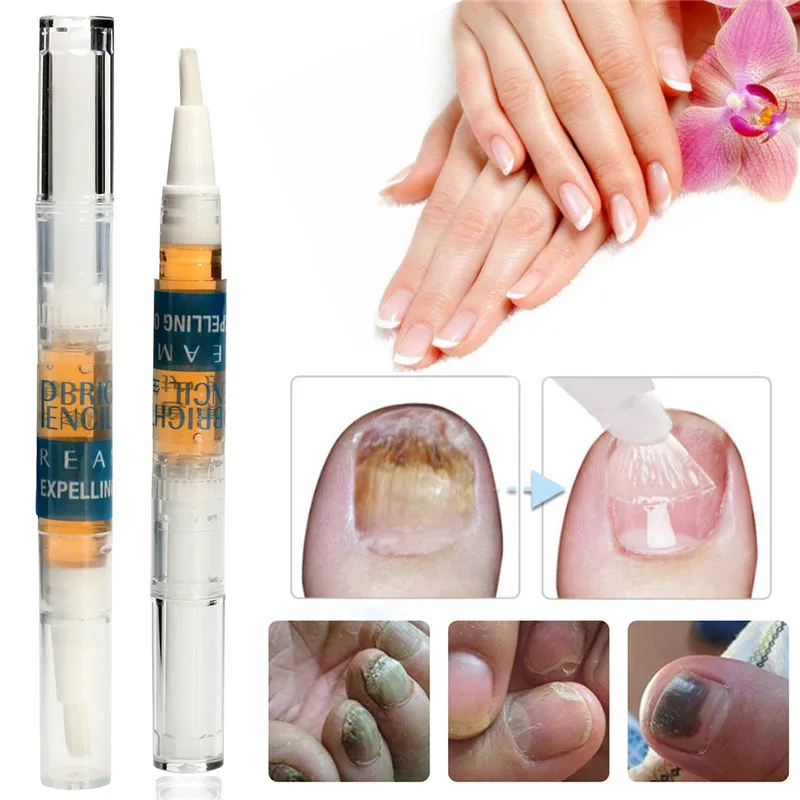 3ml Fungal Nail Treatment Pen Effective Onychomycosis Paronychia Fungus