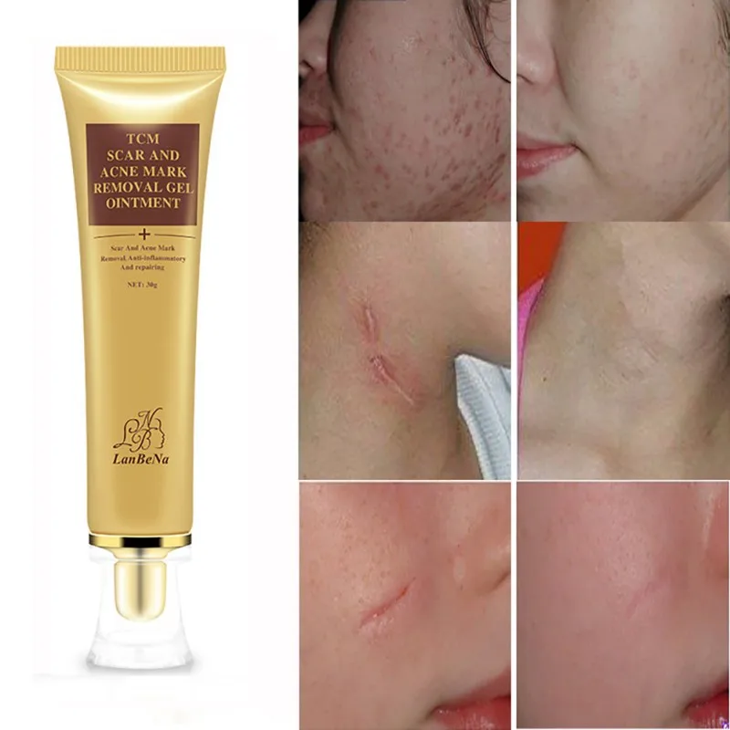 

Face Scar Removal Cream Skin Repair 30ml Face Cream Blemish Spots Treatment Blackhead Whitening Cream