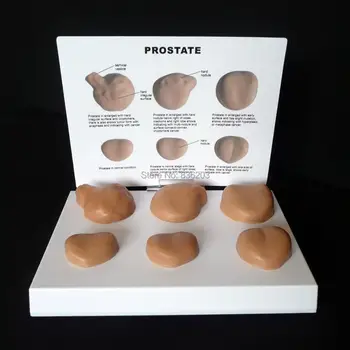 

Male Pathological Prostate Medical Life Size traumatic pistol Human anatomy traumatism Prostate Male Anatomical Model Set of 6