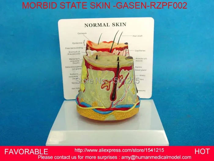 

HUMAN SKIN TISSUE STRUCTURE ENLARGED MODEL OF HAIR FOLLICLE SWEAT GLAND ENLARGEMENT,HUMAN ANATOMICAL SKIN MODEL-GASEN-RZPF002