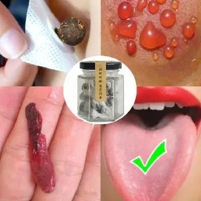 Acupuncture Massage 30/60/150 pcs Moxibustion Massage Paste Navel Stickers Moxibustion Thenar Moxa Sticker