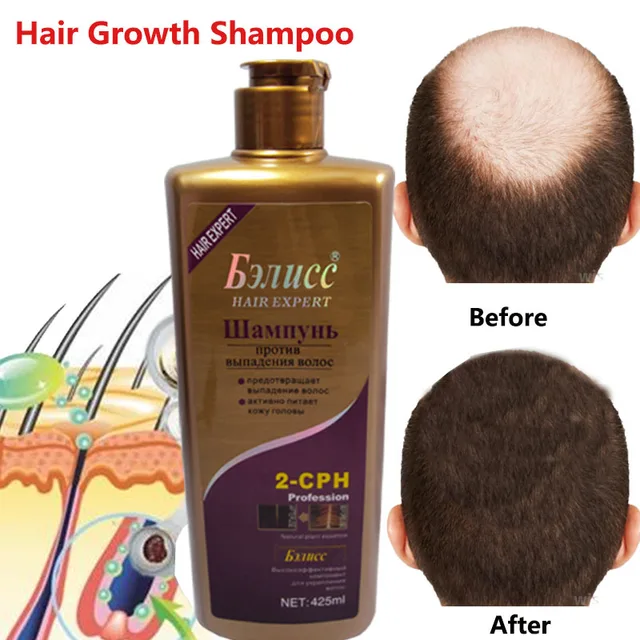 hair-shampoo-anti-off-hair-growth-natural-herbal-extracts-hair-regrowth