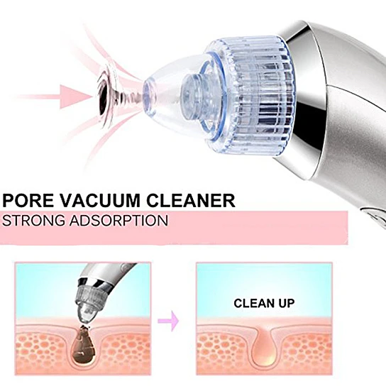 Blackhead Vacuum Extraction Removal Electronic Device (1)