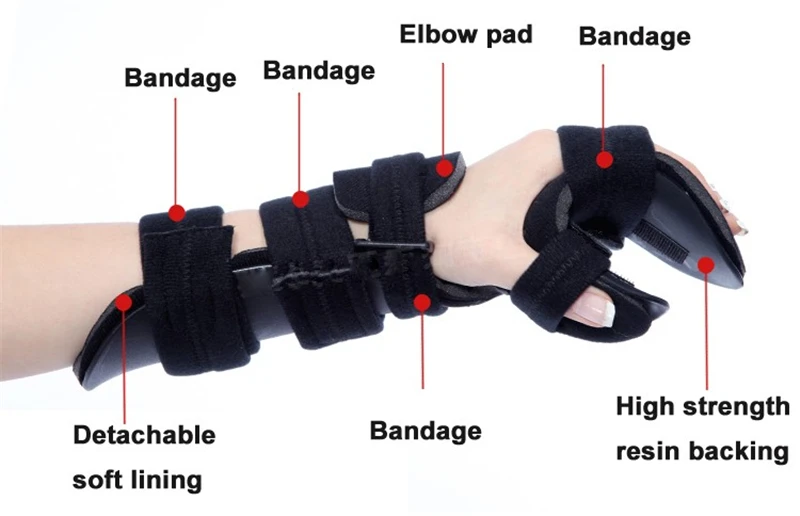 Коррекция версии палец руки запястье ортопедический тренажер реабилитации устройство церебрального инфаркта тромбоз локоть такт бесплатно