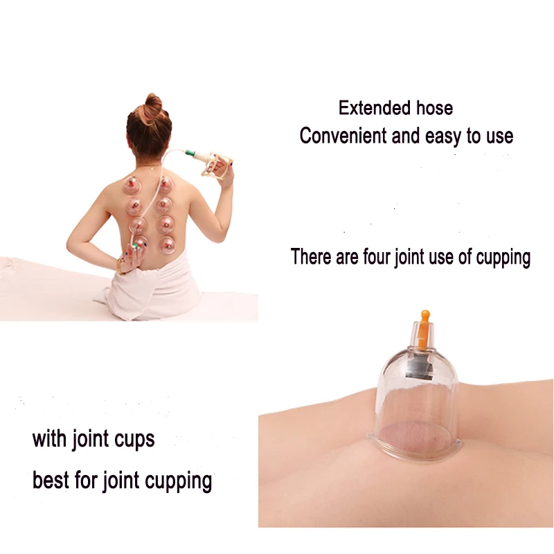 vacuum cupping (10)
