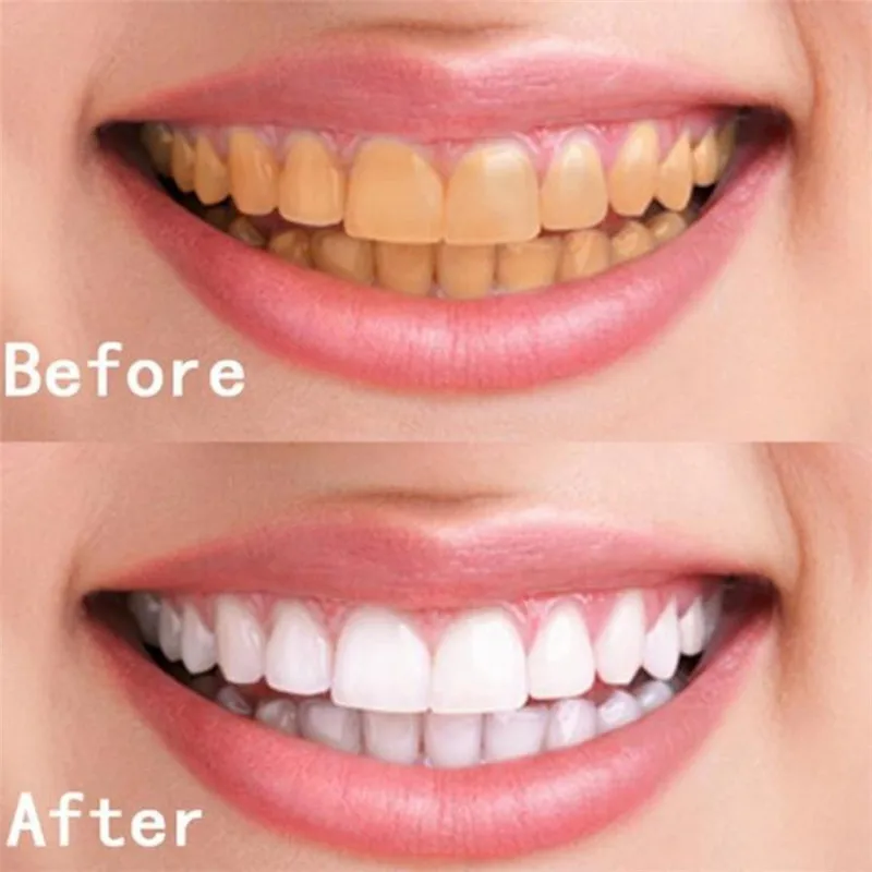 

10 ML Teeth Whitening Water Hygiene Cleaning Teeth Care Tooth Cleaning Whitening Water reduce tooth dirt enhance oral hygiene