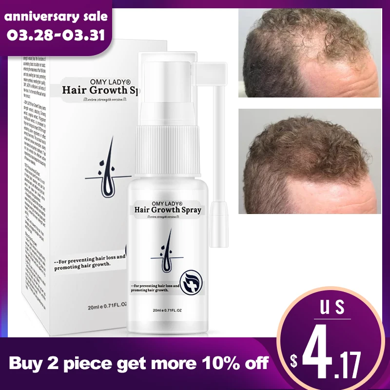

OMYLADY Hair Care Hair Growth Essential Oil Essence Original Authentic 100% Hair Loss Liquid BODY Care Beauty Dense Hair Growth