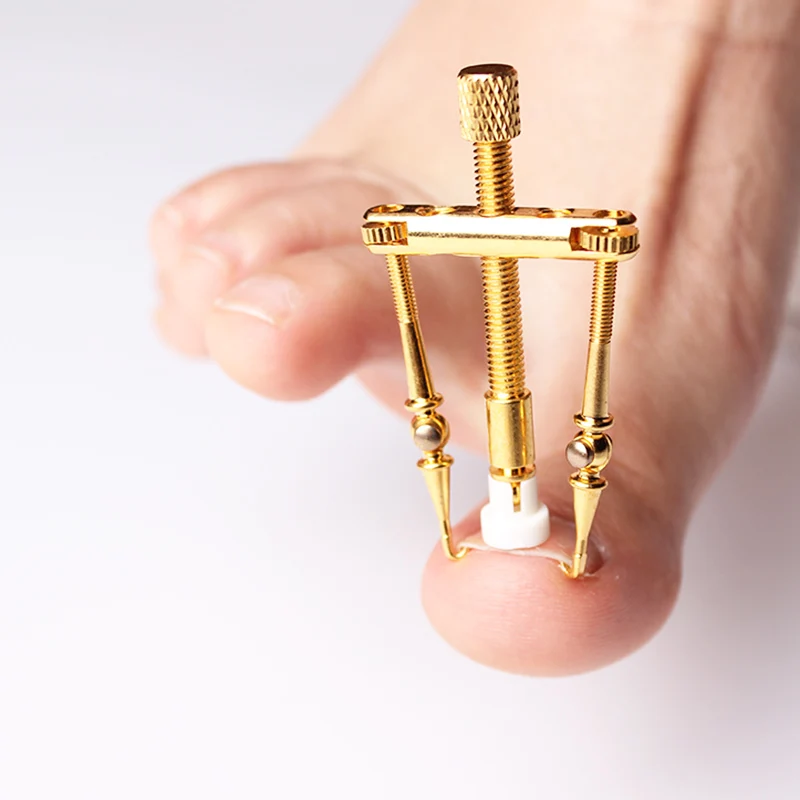 Ингольчатый ноготь для ногтей рекуперация онихокристалтоза инструмент для коррекции педикюра фиксатор для ногтей Корректор Bunion Уход за ногтями на ногах