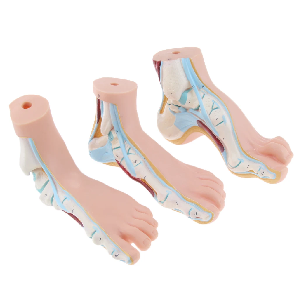 1:1 Life Size Human Foot Platypodia Bow Foot Anatomy Model Muscle Vascular