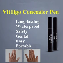 Водостойкая кожа витилиго макияж мгновенно легко Нежный белый патчи маскировки покрытие для лица, шеи, рук, ног, тела 2 шт./лот