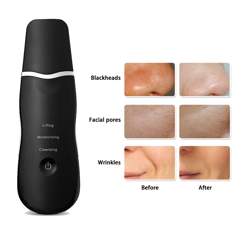 

Ultrasonic Rechargeable Face Skin Scrubber Facial Cleaning Multiple Functions Blackhead Removal Cleaner With Three Working Modes
