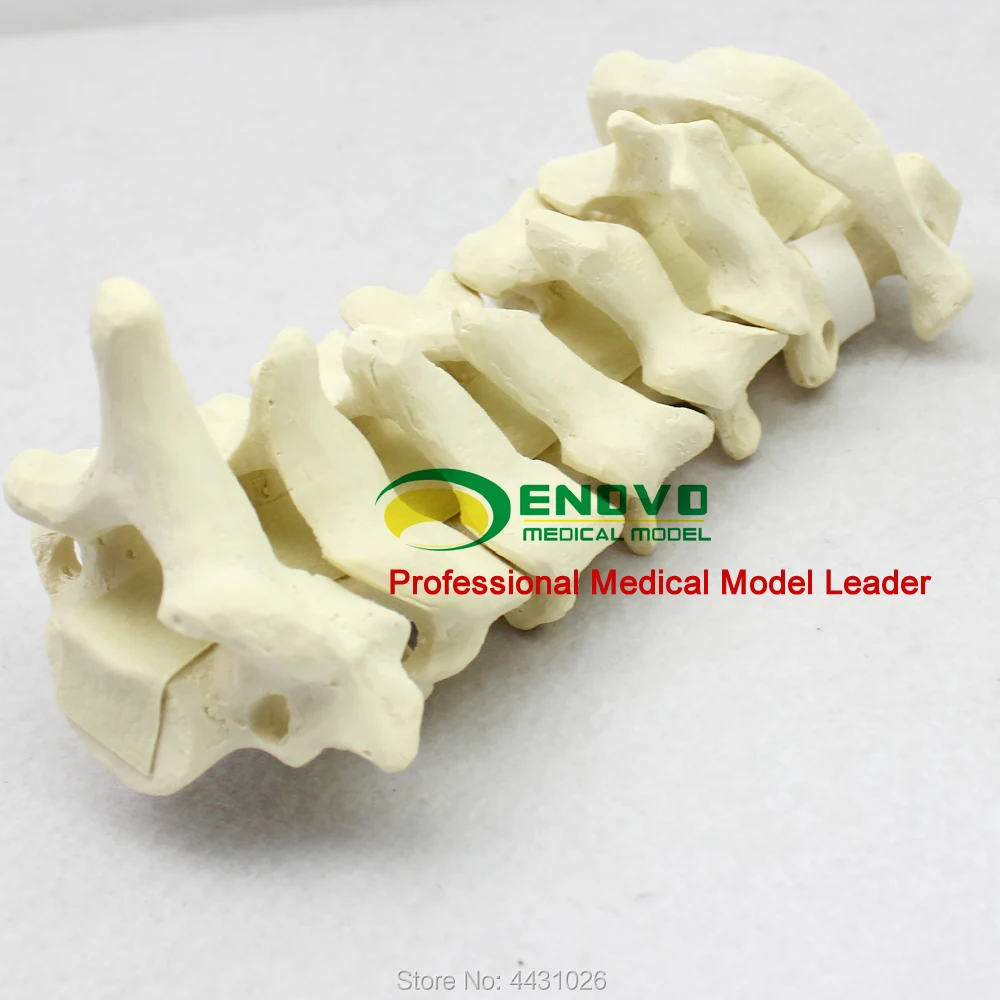 ENOVO Human Cervical Spine Model Anatomy Model Spine Statues Medical Science Teaching