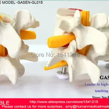 МЕДИЦИНСКАЯ ПОЯСНИЧНОГО ОТДЕЛА ПОЗВОНОЧНИКА МЕДИЦИНСКИЙ ЧЕЛОВЕЧЕСКОГО ТЕЛА человека АНАТОМИЯ ПОЯСНИЧНОГО МОДЕЛИ МЕЖПОЗВОНОЧНОГО ДИСКА ОРТОПЕДИИ МОДЕЛЬ СКЕЛЕТА-GASEN-GL015