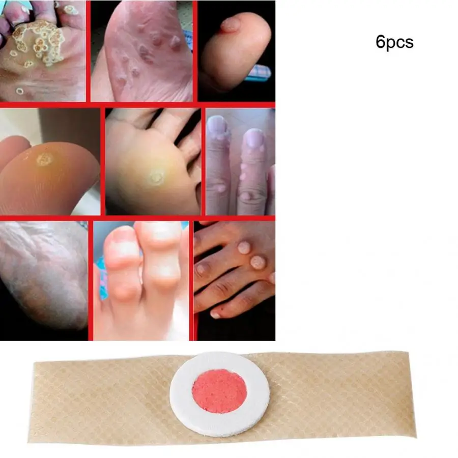 6 шт./пакет кукурузы удаления штукатурки бородавки шип патч ноги средство для удаления костных подошвенные бородавки шип удалить облегчение боли медицинский носок наклейки