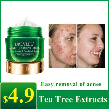 

Anti Face Cream Pimple Removal Spots Oil Control Shrink Pores Skin Care Serum Acne Treatment Cream Hot