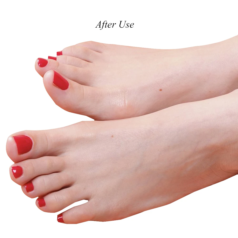 1pc Ingrown Toenail Corrector Manicure Clipper Pedicure Care File Tool Stainless Curvy Toe Fixer Protector Recover Device CH743
