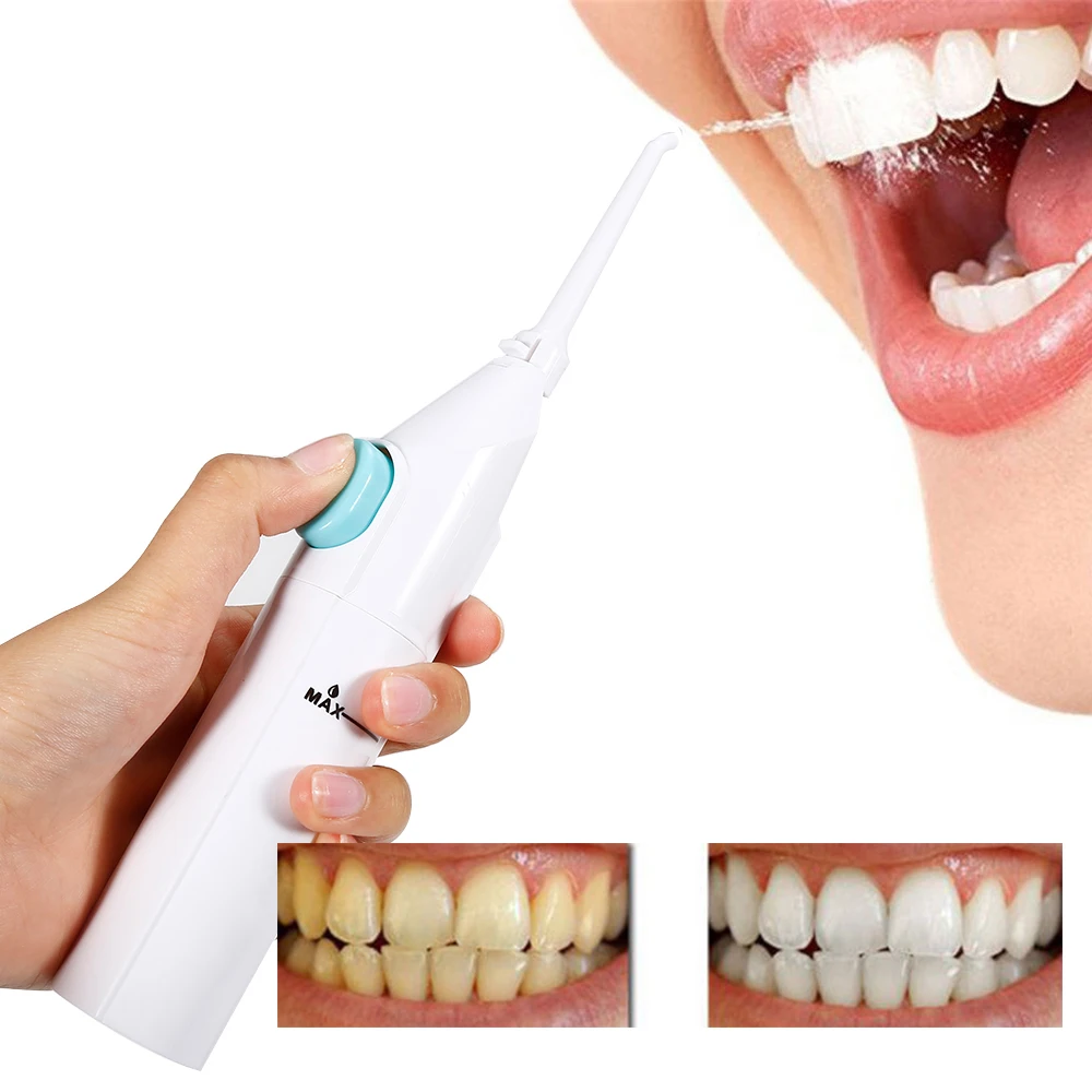 Чистка Зубов Цена