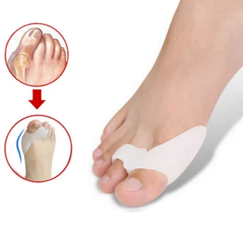 1Pair Hallux Valgus Corrector Bone Thumb Orthotic Orthopedic Silicone Big Toe Separator Bunion Corrector Pedicure Foot Care Tool