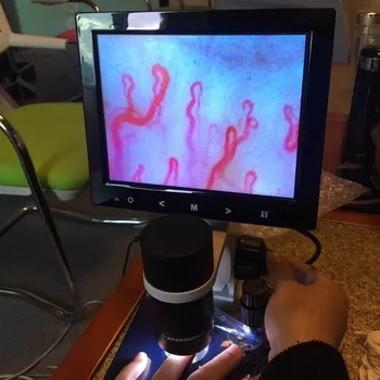 

nailfold video capillaroscope detection instrument microcirculation microscope with CE certificate