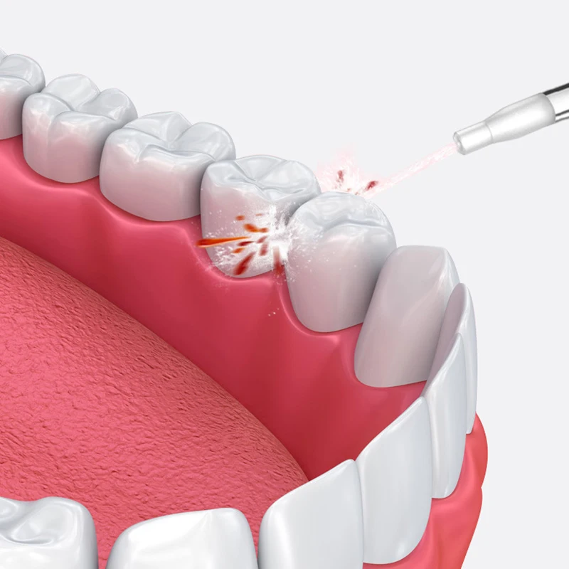 EAS-Ipx7 водонепроницаемый ирригатор полости рта воды Flosser перезаряжаемые аппарат для чистки зубов