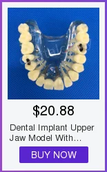 Modelo de Gesso Molde de Base de Silício Dental Bloco Completo-roxo Suprimentos Edentulous Jaw 2 Pçs - Set 36 Dental Modelo De Gesso Molde de Base