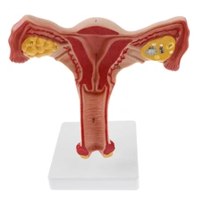 

1:1 Human Female Uterus Ovary Fallopian Tubes Model Anatomical Study Display