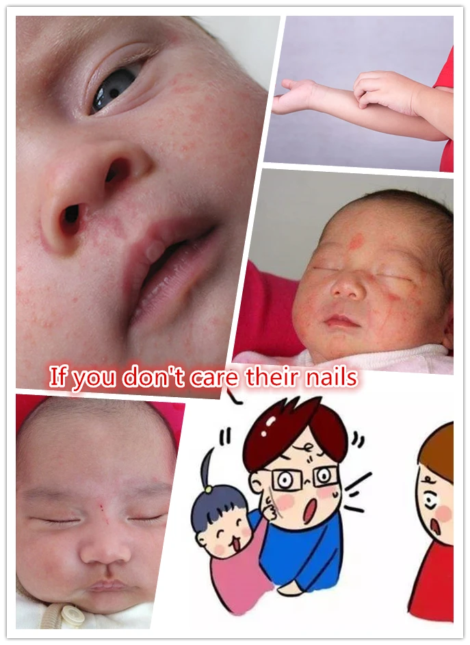 if you don't care their nails