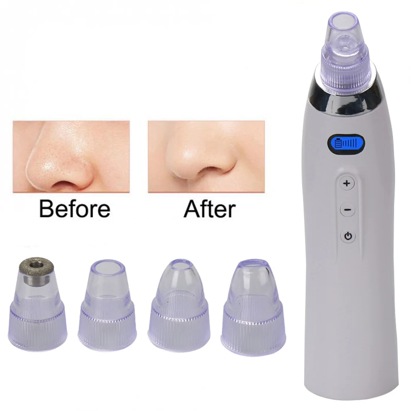 

4 Tips 5Level Skin Care Diamond Microdermabrasion Peeling Machine Facial Acne Pore Blackhead Vacuum Suction Beauty Device