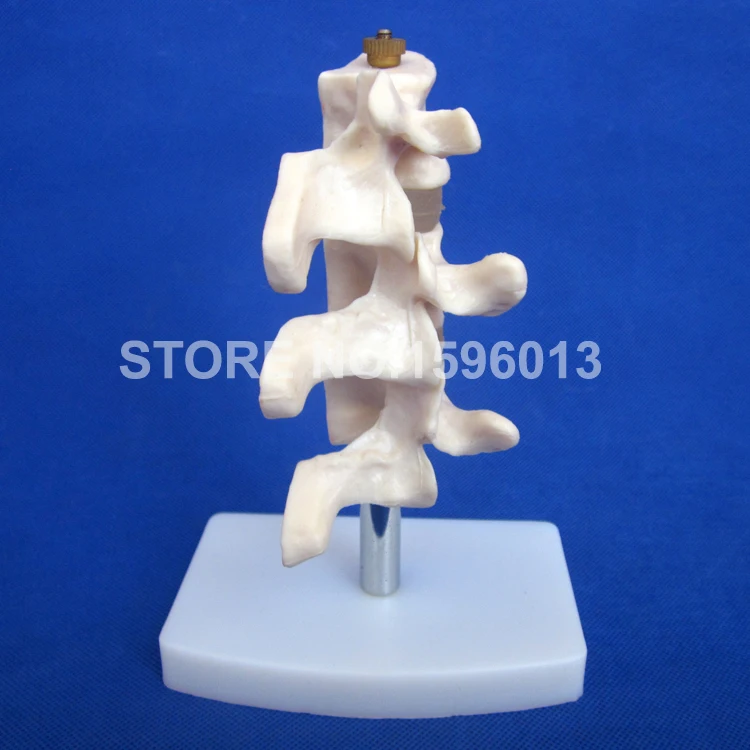 134 osteoporosis model (4)