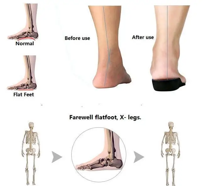 Ортопедические стельки 3D Ева стельки Плоскостопие арки Поддержка вставки обуви для Для мужчин/Женская обувь ортопедические стельки ноги