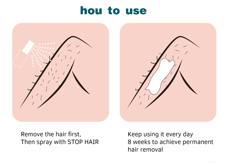 Ингибирует рост волос спреи безболезненное удаление волос предотвращает рост волос мягкая увлажняющая не раздражающая восстанавливающая эссенция TSLM1
