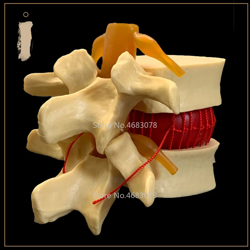 1:1 анатомический Скелет спина поясница грыжа диска Учебная модель мозг череп черепно-пистолет школьные медицинские расходные материалы