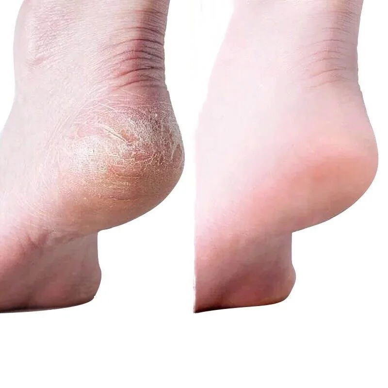 foot cream