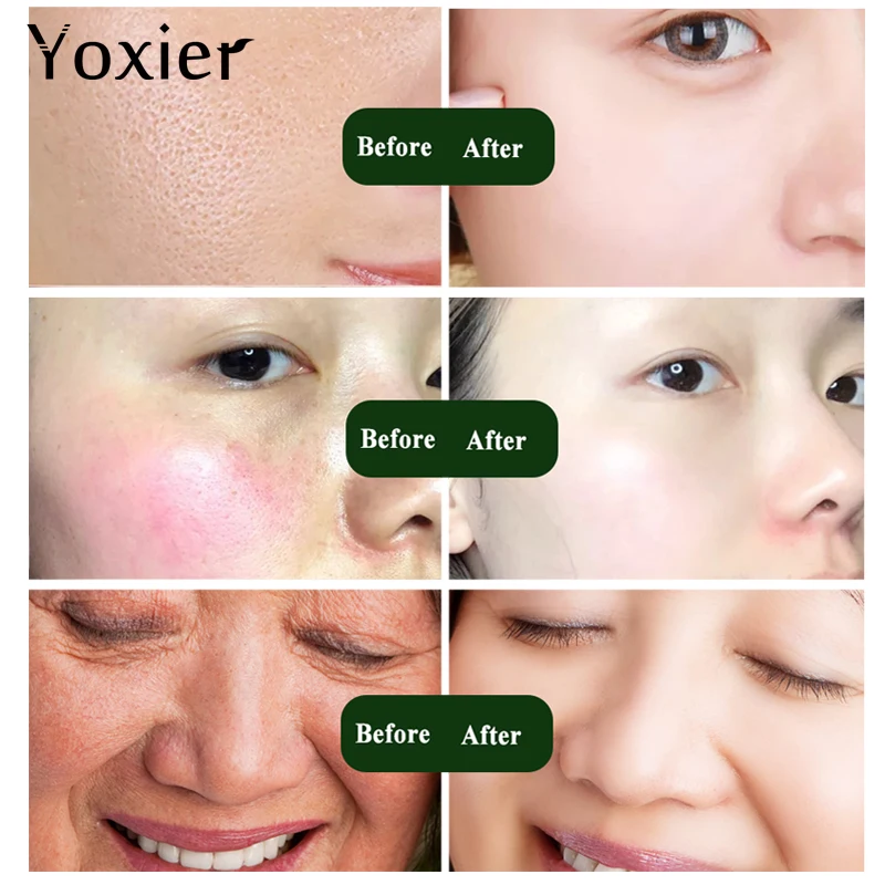 Yoxier Serum Face Anti-Aging Snails Hyaluronic Acid Six Peptide Concentrate Face Care Moisturizing Oil-control Snail Essence