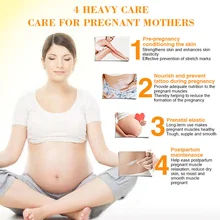 Стрейч Марка беременность крем для удаления шрамов ремонт кожи крем по уходу за телом- MS