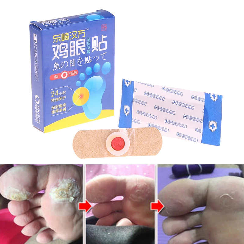 

8 pcs/box Exfoliating Corn Foot Patch Foot Plantar warts Calluses Away Soft Feet Problem Remove Hard Dead Skin Treatment Removed