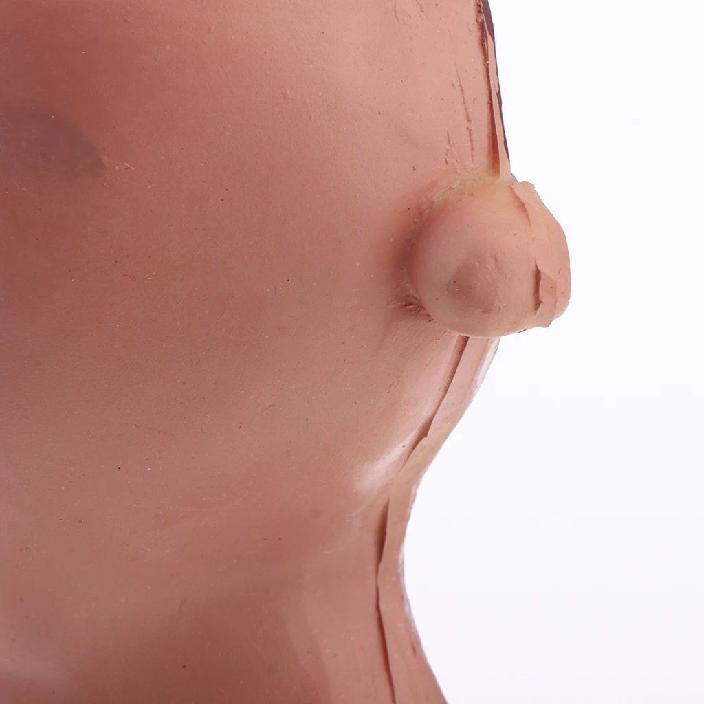 5x Pathological Rectum with Anus Hemorrhoid, Human Anatomical Model Anorectal Diseases Learning for Student Teacher Acss