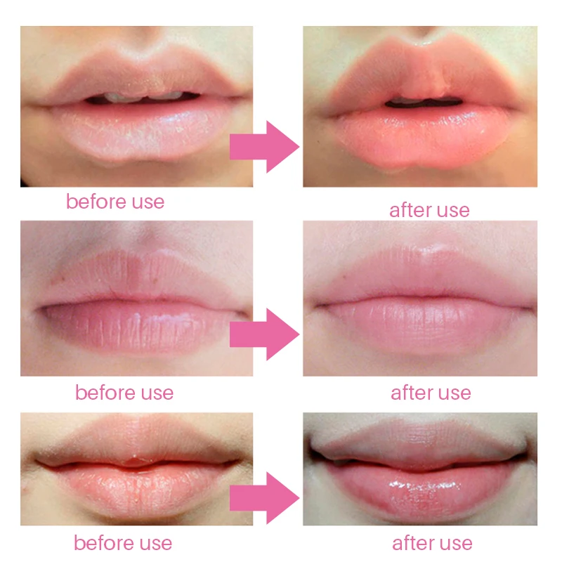 10/20 Pcs Lip Mask Moisturizing Remove Lines Blemishes Exfoliating Lip Plumper Essentials Anti Ageing Wrinkle Lip Gel Mask TSLM1
