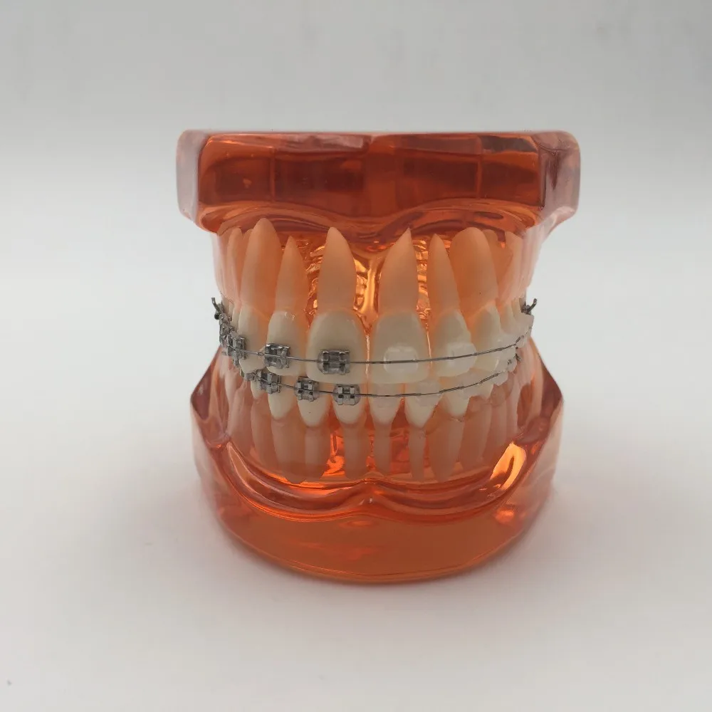 Modelo de Ortodontistas com Metal Dentista de Metal Alta Qualidade Novo Suportes Cerâmicos Ortopedia Paciente Estudante Aprendizagem Modelo 2020 & 7 Cheap Clareamento dos dentes